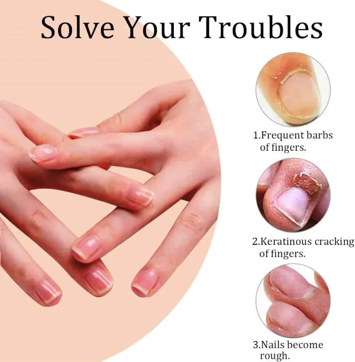 Nail Growth Oil Pen for Nails Repair,Nail Growth and Strength (For Both Hand Nails and Foot Nails)