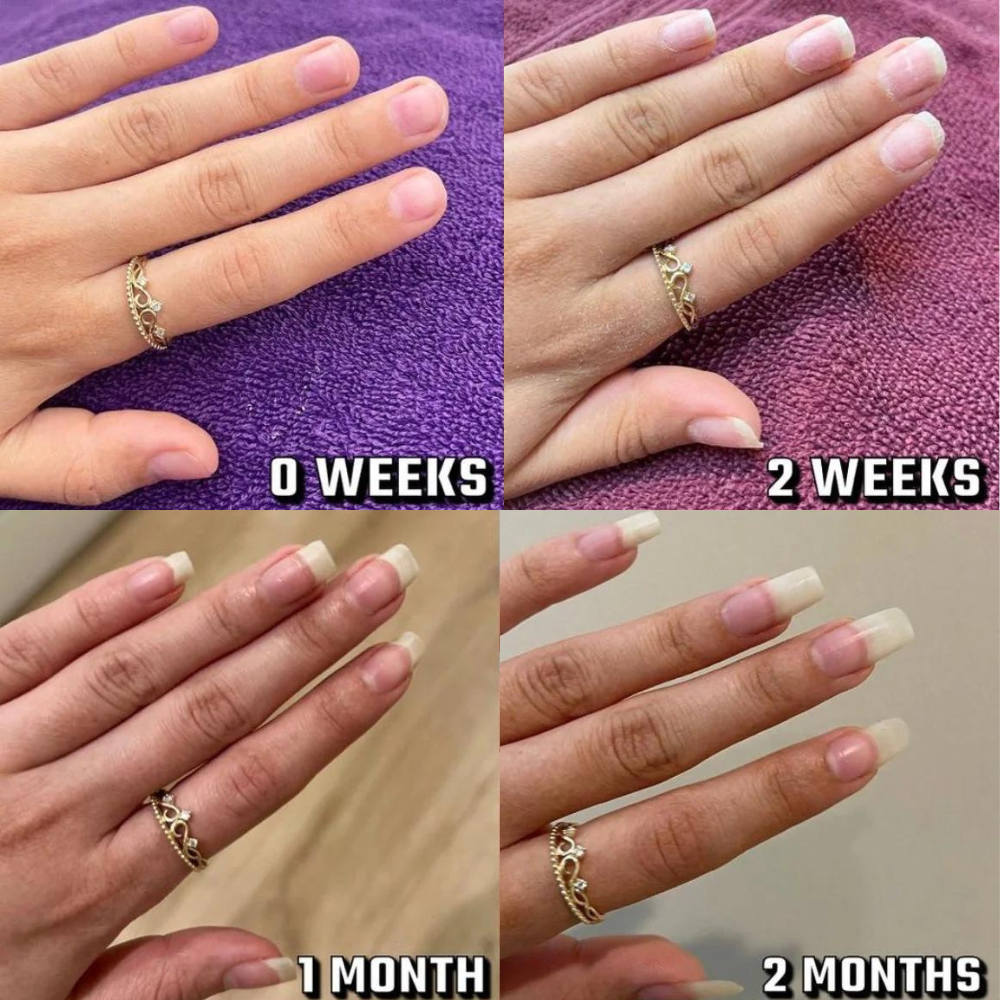 Nail Growth Oil Pen for Nails Repair,Nail Growth and Strength (For Both Hand Nails and Foot Nails)