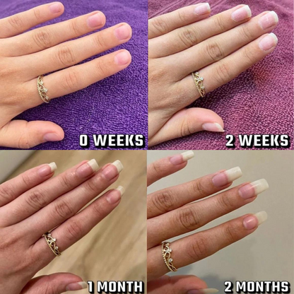 Nail Growth Oil Pen for Nails Repair,Nail Growth and Strength (For Both Hand Nails and Foot Nails)