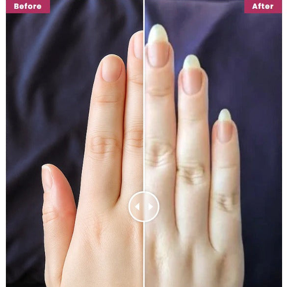 Nail Growth Oil Pen for Nails Repair,Nail Growth and Strength (For Both Hand Nails and Foot Nails)